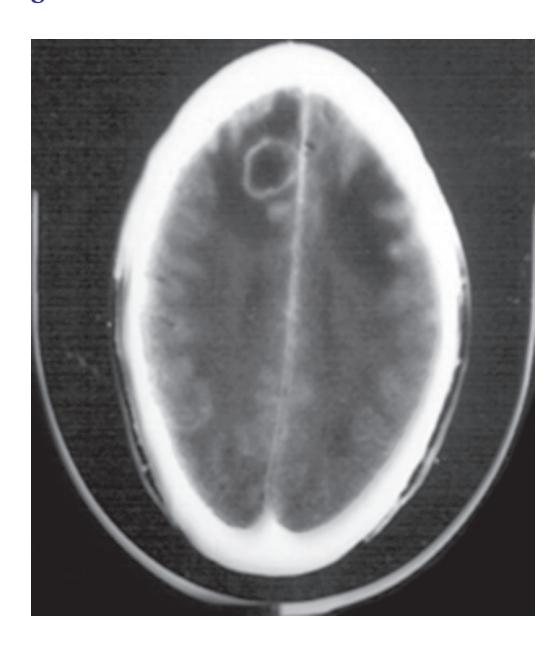 images/VVK-P-Osce 8. Infection_page_10_Picture_26.jpeg