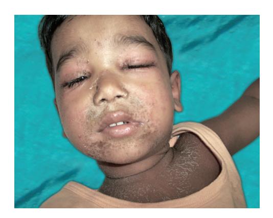 images/VVK-P-Osce 8. Infection_page_11_Picture_11.jpeg
