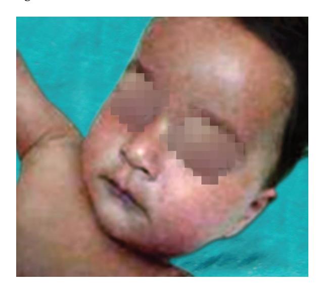 images/VVK-P-Osce 8. Infection_page_3_Picture_16.jpeg