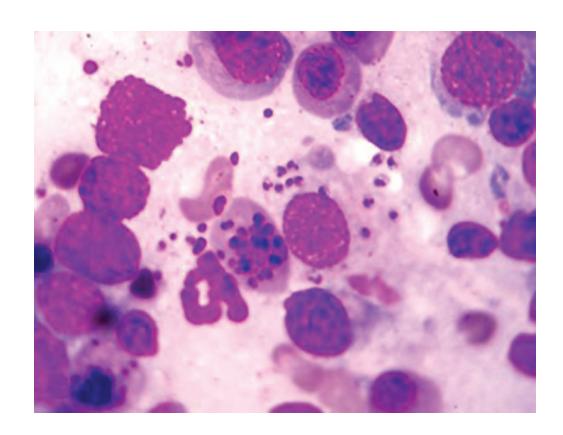 images/VVK-P-Osce 8. Infection_page_7_Picture_13.jpeg