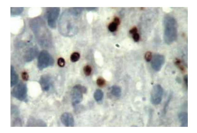 images/VVK-P-Osce 8. Infection_page_7_Picture_3.jpeg