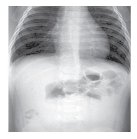 images/VVK-P-Osce 8. Infection_page_9_Picture_9.jpeg