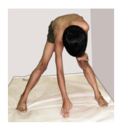 images/VVK-P-Osce 9. Neurology_page_0_Picture_10.jpeg