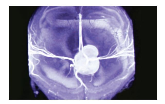 images/VVK-P-Osce 9. Neurology_page_3_Picture_3.jpeg