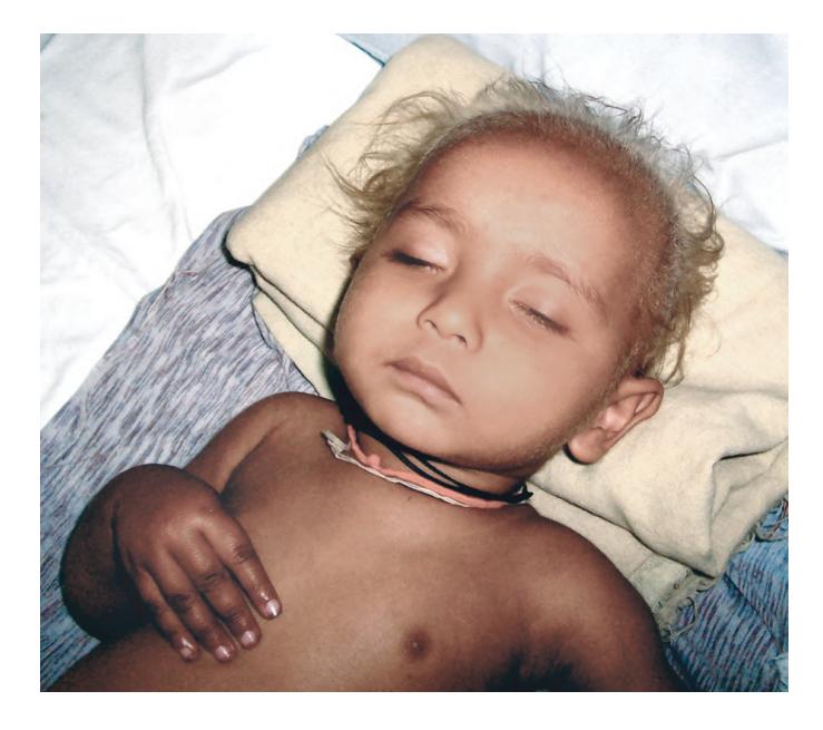images/VVK-P-Osce 9. Neurology_page_6_Picture_12.jpeg