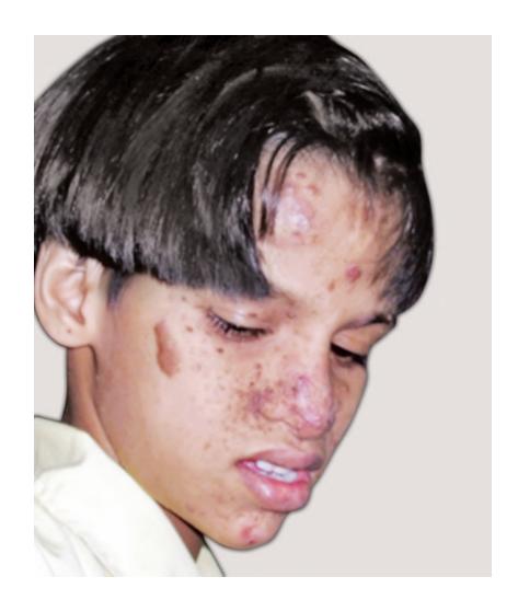 images/VVK-P-Osce 9. Neurology_page_8_Picture_3.jpeg