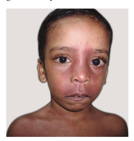 images/VVK-P-Osce 9. Neurology_page_8_Picture_9.jpeg